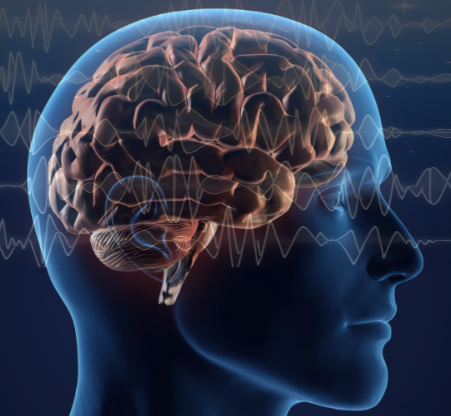 Eeg